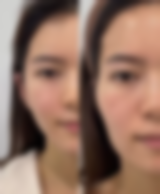 六、芜湖爱容医疗美容门诊部如何口碑如何？