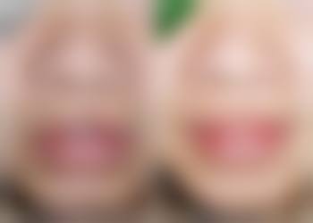 生活调理改善眼袋