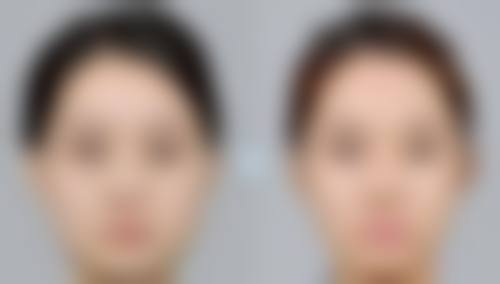 七、武汉羞花医疗美容宋静芸医生怎么预约？