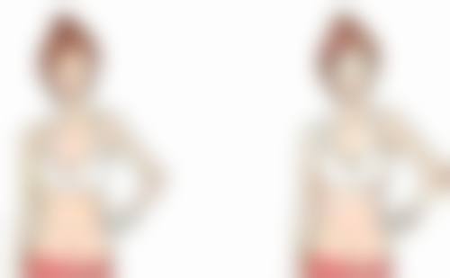 五、郑州至美医疗美容白衡翼医生技术怎么样？