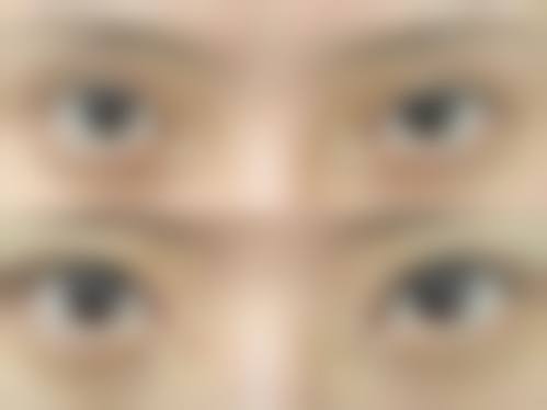 六、诸暨欧莱美整形医院口碑如何？