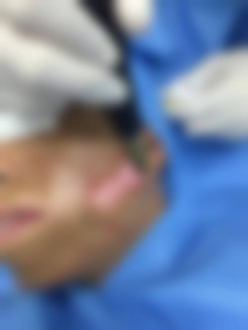 六、马鞍山颜丽医疗美容门诊部口碑如何？