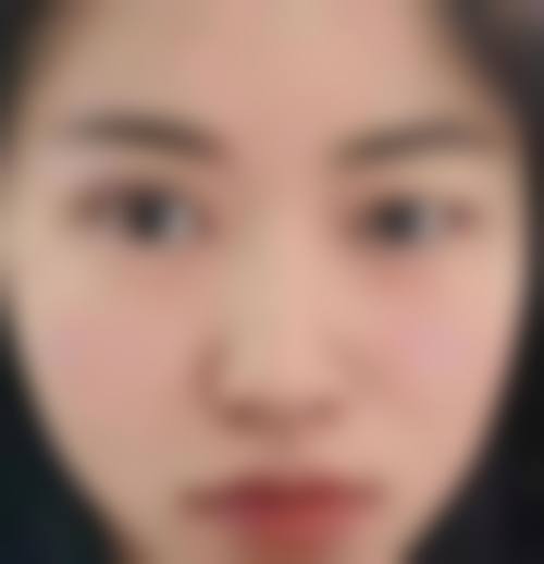 六、深圳伊慈佑整形医疗美容门诊部口碑如何？