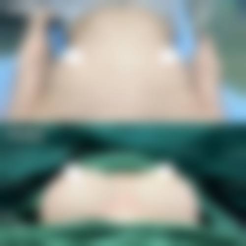 六、鞍山张玉霞星范医疗美容门诊部口碑如何?