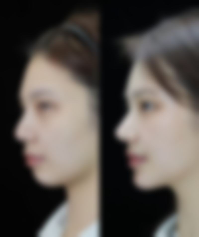 八、松原伊美莱医疗美容诊所怎么预约？