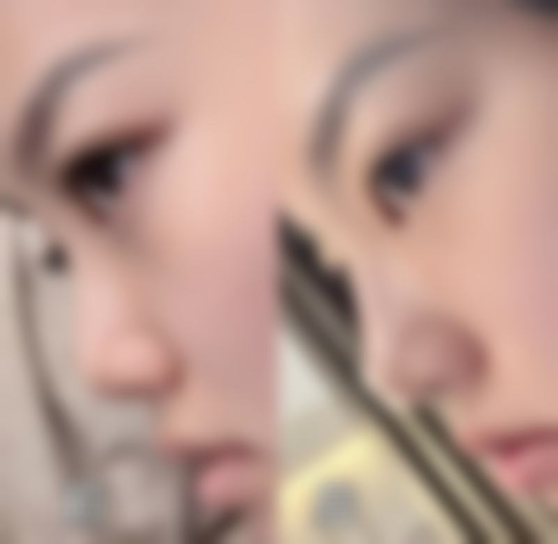 四、龙岩前列医院 - 烧伤整形美容医院特色项目