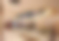 时代天使隐形矫正COMFOS 22800元起的价格优势