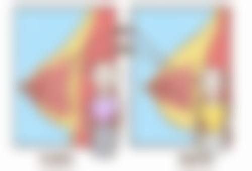 影响眼皮表现的其他因素