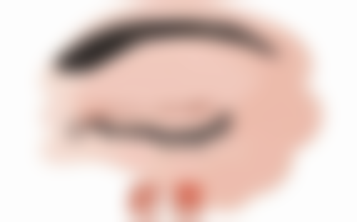 日常护理对消除疤痕增生的重要性