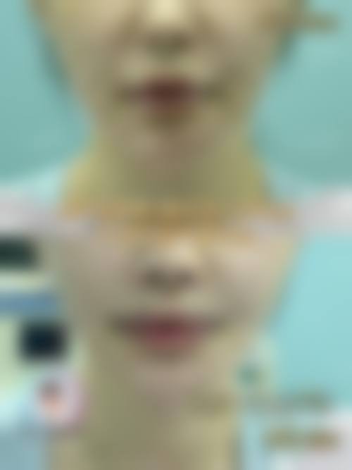 五、TCB 富山收费价格表