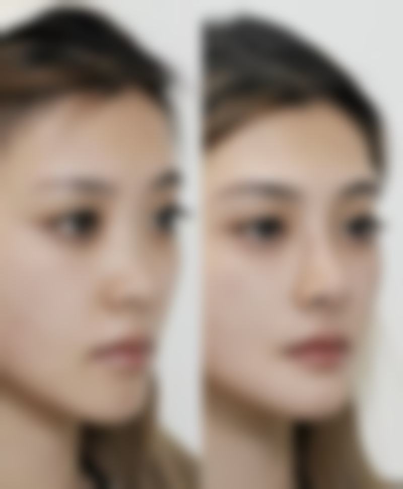 四、成都欣亚医疗美容王皓民医生坐诊医院