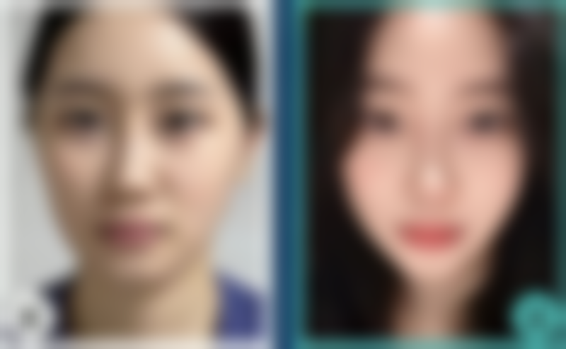 脸上疤痕发痒是不是修复？不能仅以此判断，需结合诱因、症状综合分析，教你应对方法！ 