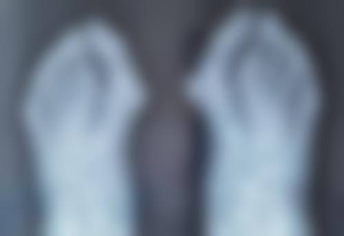 橄榄油消除眼袋的主流观点