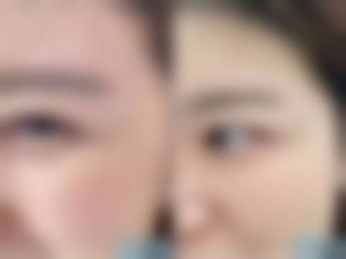 瘦脸针跟溶脂针有什么区别？从作用机制、适用部位到效果等多方面为你详细剖析！ 