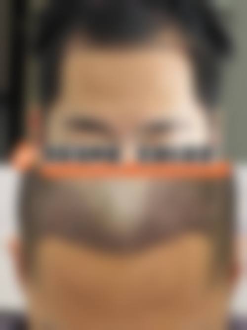 八、深圳港龙医院私密科怎么预约?