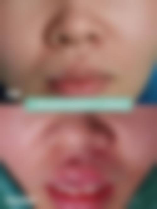 八、宝鸡中 心医院烧伤整形科怎么预约?