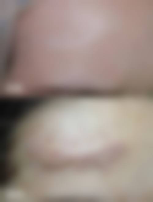 四、南京瑞鑫烧伤专科医院特色项目