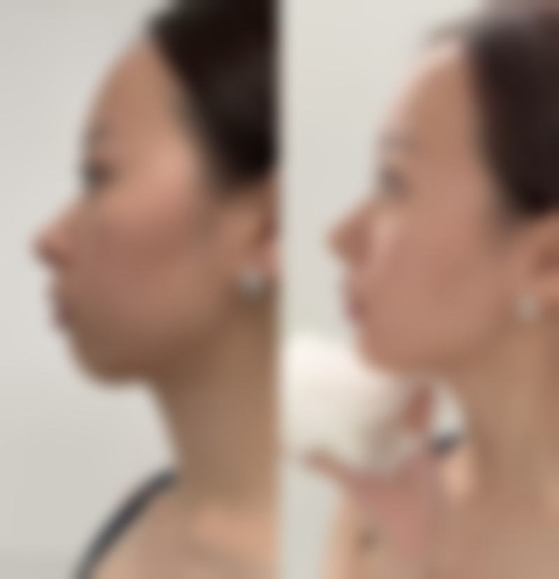 八、淮安童颜医疗美容怎么预约?