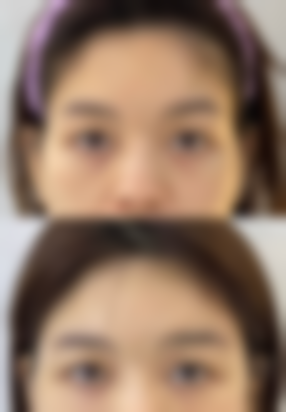 五、西安迪美医疗美容诊所收费价格表