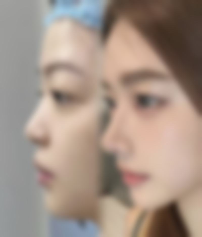 认为橄榄油有作用的观点