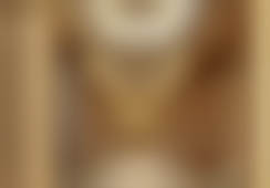 南通英莎医疗美容门诊部做全切双眼皮与眼袋外切二选一项目的优势