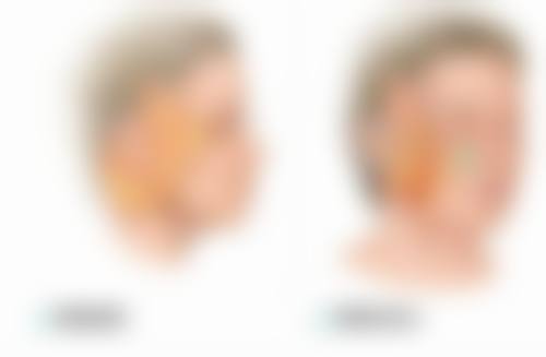 二、北京海医悦美纪勍医生擅长项目