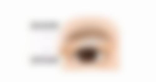 术前注意事项与风险评估