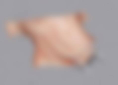 六、北京南加整形医院口碑如何?