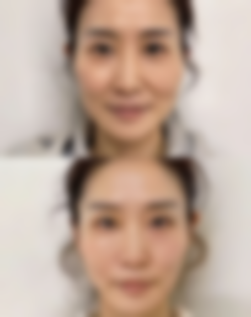 黛元堂去眼袋真好使吗？真实用户分享：使用后眼袋明显变小，效果显著值得一试！ 