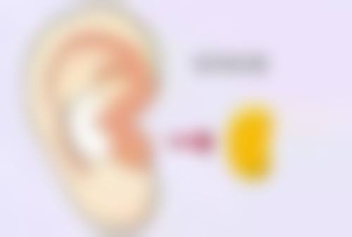 重度凹陷疤痕的应对方法