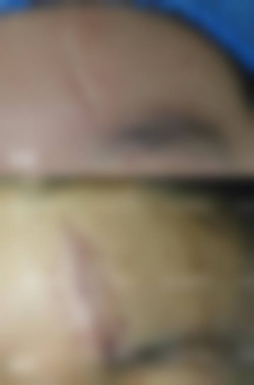 二、陕西省核工业二一五医院烧伤整形科正规吗？来看医院资质信息