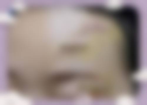 八、陕西省核工业二一五医院烧伤整形科怎么预约？