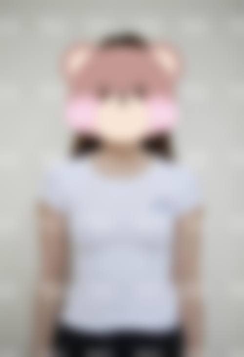 四、西安优立塑整形医院特色项目