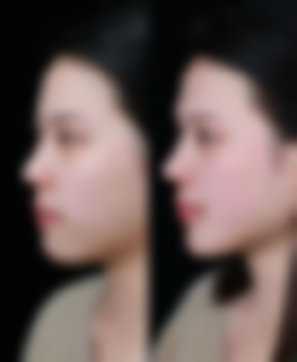 四、南宁广丽医疗美容门诊部特色项目