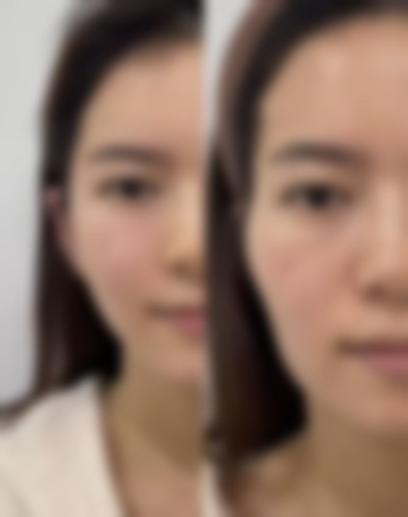 二、西安优立塑整形医院正规吗？来看医院资质信息