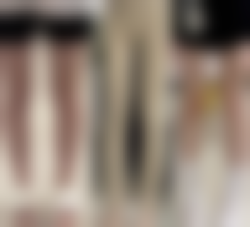 手术双眼皮:持久与个性化定制