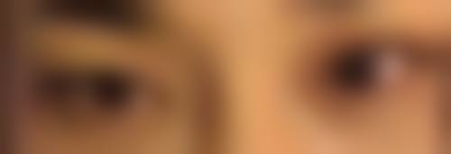 六、重庆尚韩医疗美容刘兴振医生口碑评价及真人实例反馈