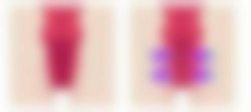 五、烟台莱阳中 心王利民医生技术怎么样?