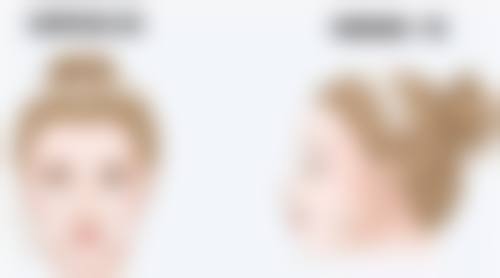 五、厦门厦门大学附属翔安贾赤宇医生技术怎么样？