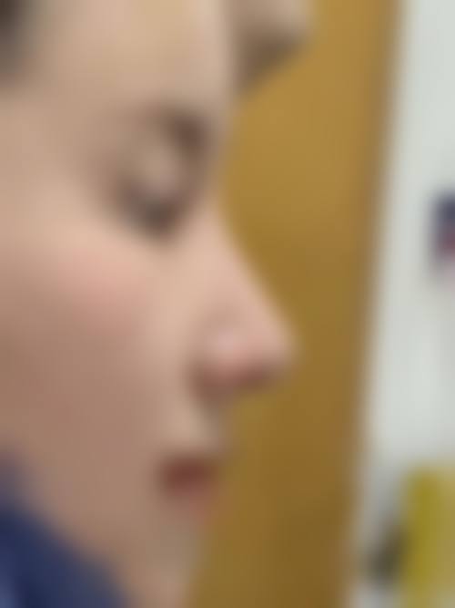 八、玉林医奢美医疗美容诊所怎么预约?