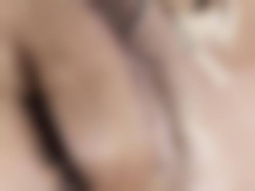 四、濮阳第二人民医院整形美容科特色项目