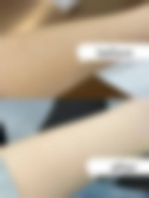 五、东莞市艾丽尔医疗美容门诊部收费价格表