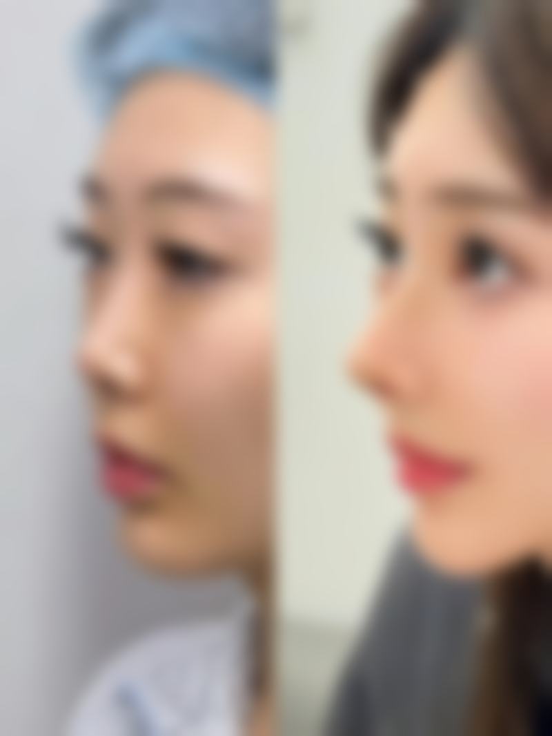 六、玉林医奢美医疗美容诊所口碑如何?