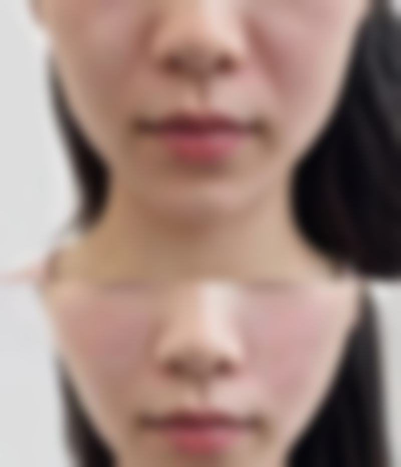 二、烟台莱阳中 心王利民医生擅长项目