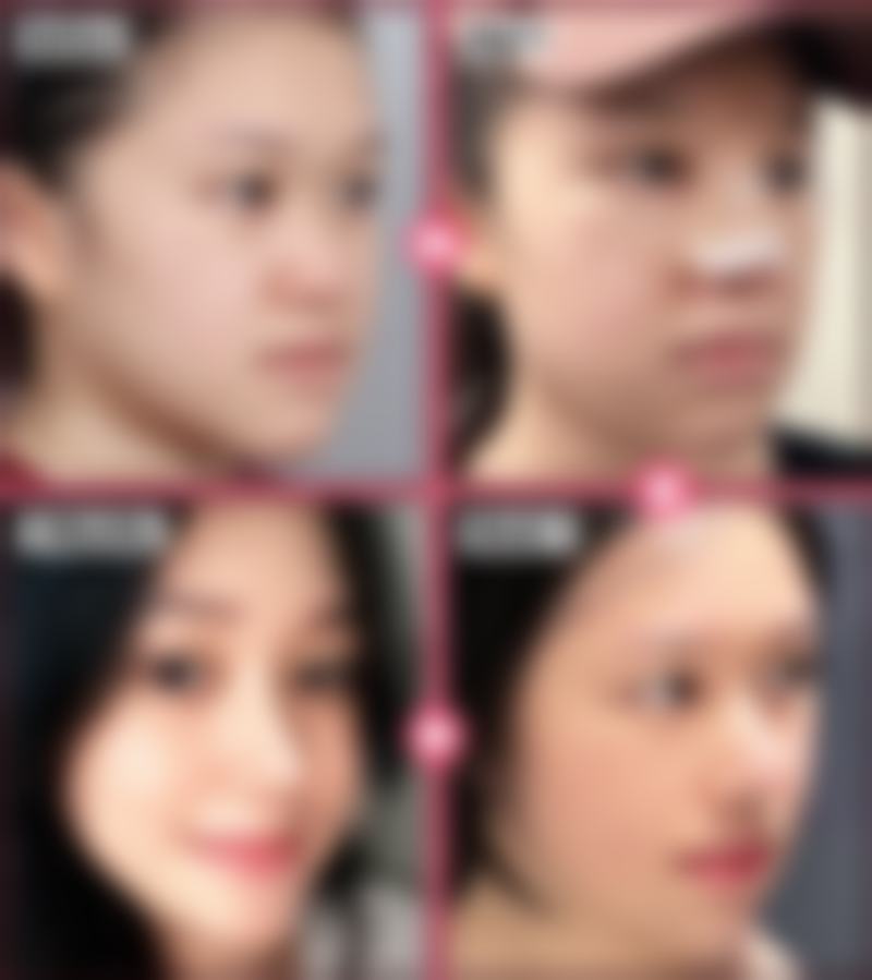 五、玉林医奢美医疗美容诊所收费价格表