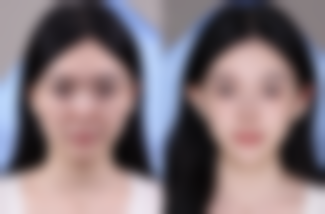 五、成都天后整形医疗美容收费价格表