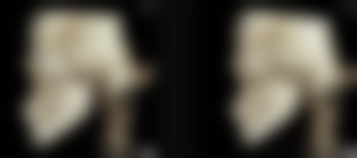 物理治疗：改善疤痕外观