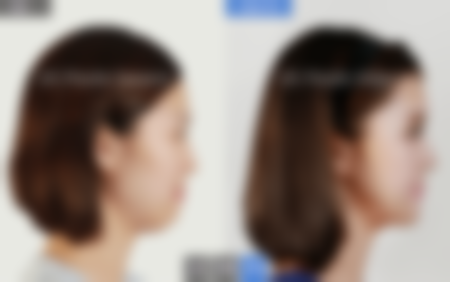 八、韩国BK整形医院怎么预约?