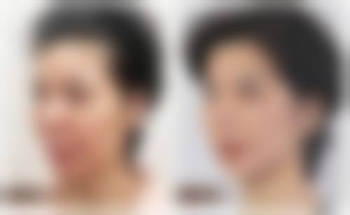 其他可能的因素