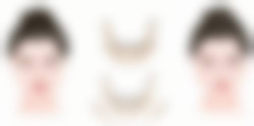 术后护理对修复的重要性